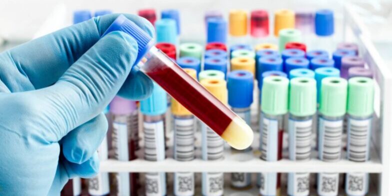erros-na-coleta-de-sangue-que-seu-laboratorio-nao-pode-cometer.jpeg