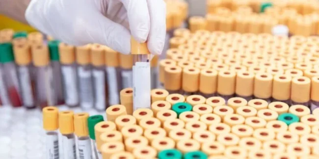 Conheça 5 boas práticas para o transporte de material biológico – Unilab Software para Laboratório Conheça 5 boas práticas para o transporte de material biológico - Unilab Software para Laboratório