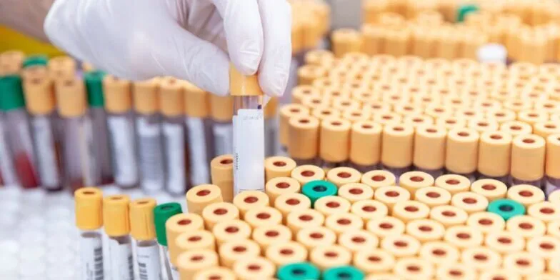 Conheça 5 boas práticas para o transporte de material biológico - Unilab Software para Laboratório