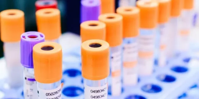 Veja como otimizar a gestão de armazenamento de material biológico - Unilab Software para Laboratório