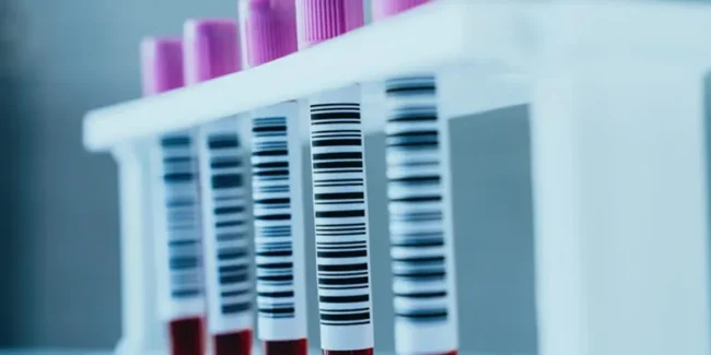 Rastreabilidade de Materiais Biológicos: Como Garantir Segurança e Controle no Laboratório – UNILAB – Software para Laboratório Rastreabilidade de Materiais Biológicos: Como Garantir Segurança e Controle no Laboratório - UNILAB - Software para Laboratório