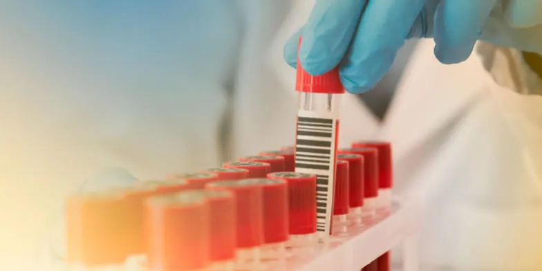 A importância da soroteca para ficar em dia com a RDC 786:2023 – Unilab Software para Laboratório A importância da soroteca para ficar em dia com a RDC 786:2023 - Unilab Software para Laboratório