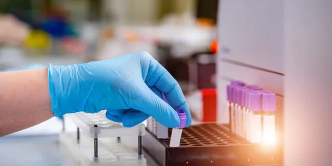Como Divulgar as Melhorias do Laboratório para o Mercado e Fortalecer Sua Marca – UNILAB – Software para Laboratório Como Divulgar as Melhorias do Laboratório para o Mercado e Fortalecer Sua Marca - UNILAB - Software para Laboratório